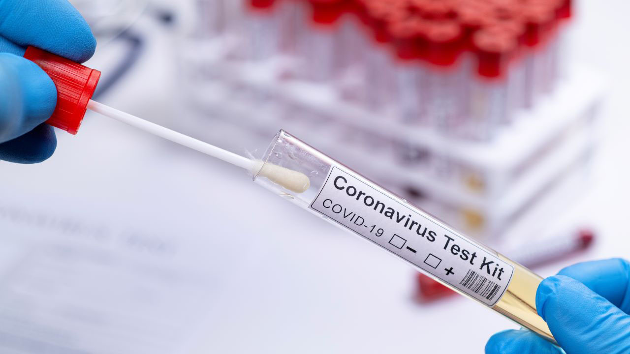healthcare-photography-website-blog-coronavirus-test-kit-1280x720oTN3dct9sAJz0 Mit Barcodelösungen im Einsatz gegen Corona